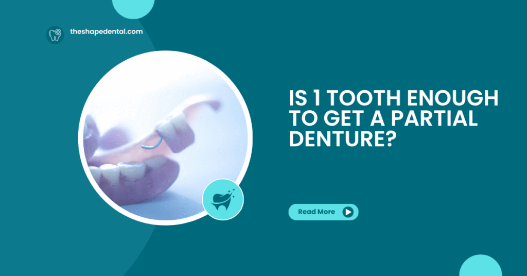 Is 1 Tooth Enough To Get A Partial Denture Fluoride Treatment