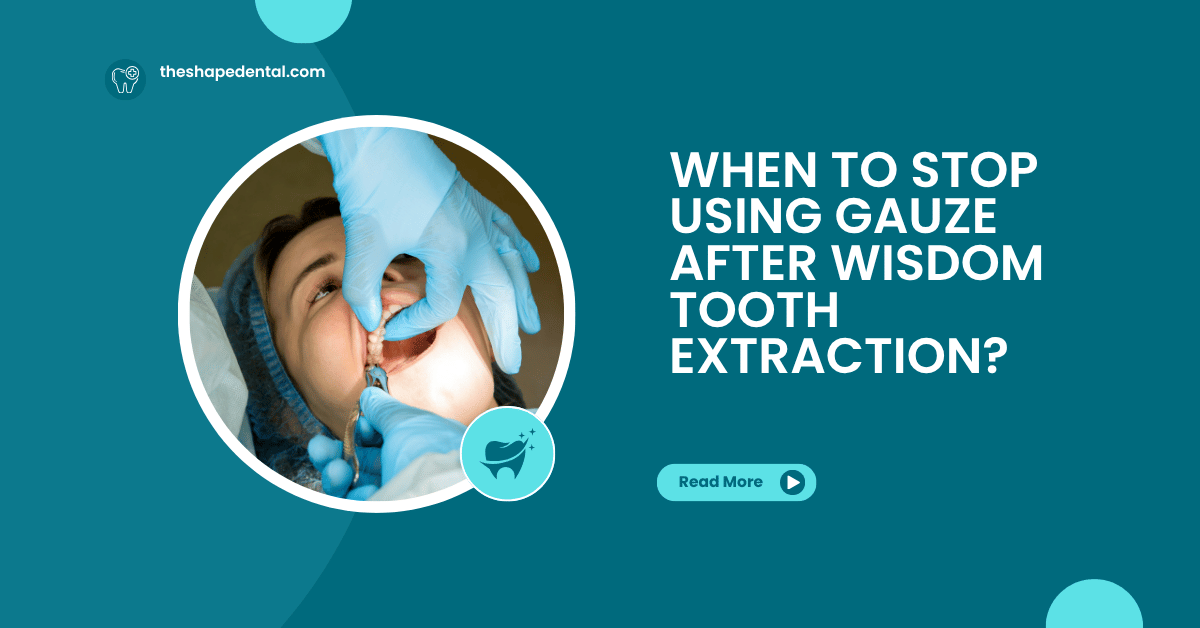 Wisdom Tooth Extraction Terms Root Canal Therapy