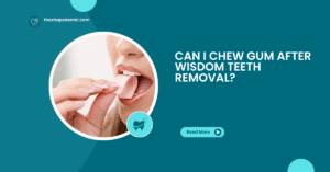 Blog 13 Can I Chew Gum After Wisdom Teeth Removal? Dentist Berry Creek