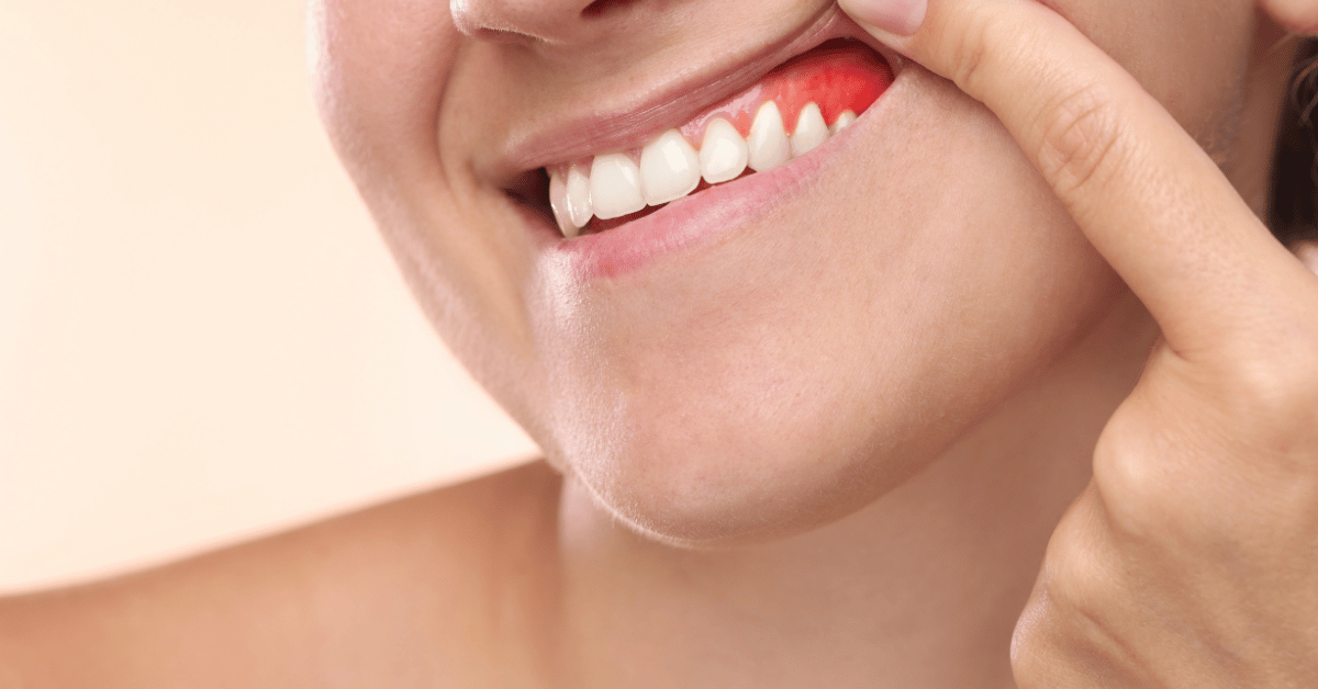 Gum Pain in One Spot