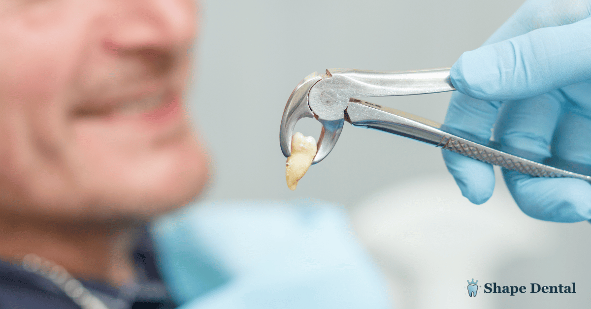Wisdom Tooth Extraction