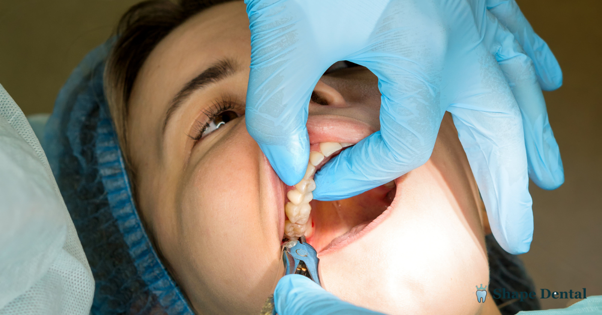 9 Warning Signs of a Failed Dental Bone Graft 3 Signs of a Failed Dental Bone Graft