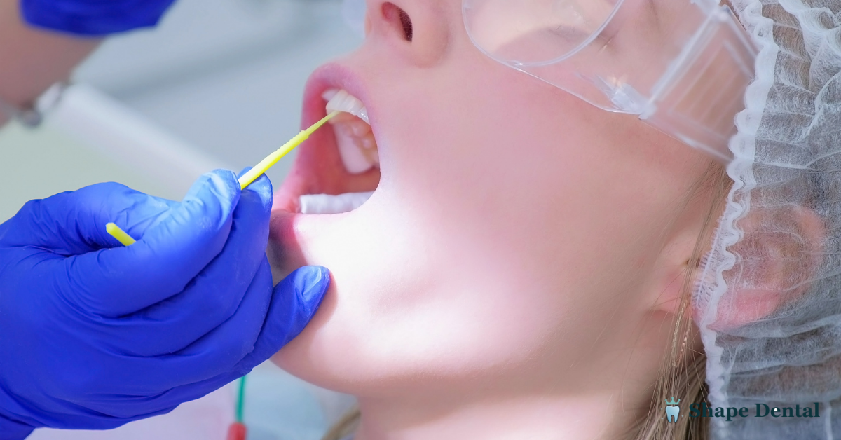 How Long After Fluoride Treatment Can I Drink Coffee? 2 Fluoride Treatment