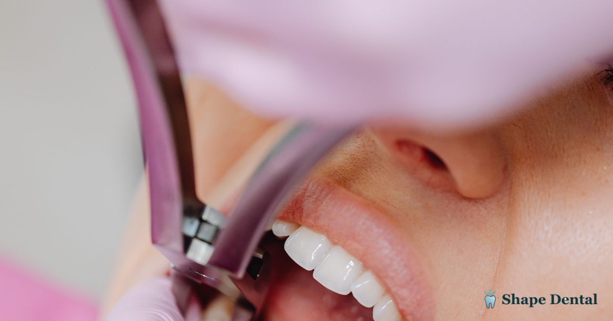 How Long Until a Tooth Infection Kills You