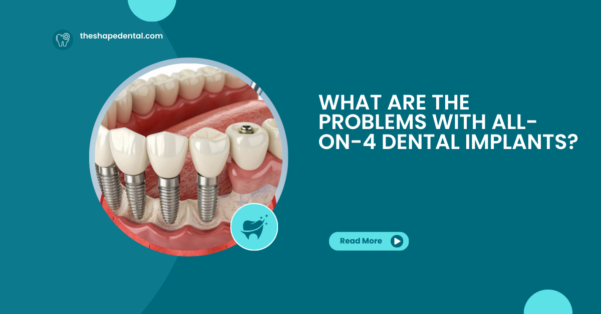 all on 4 dental implant problems