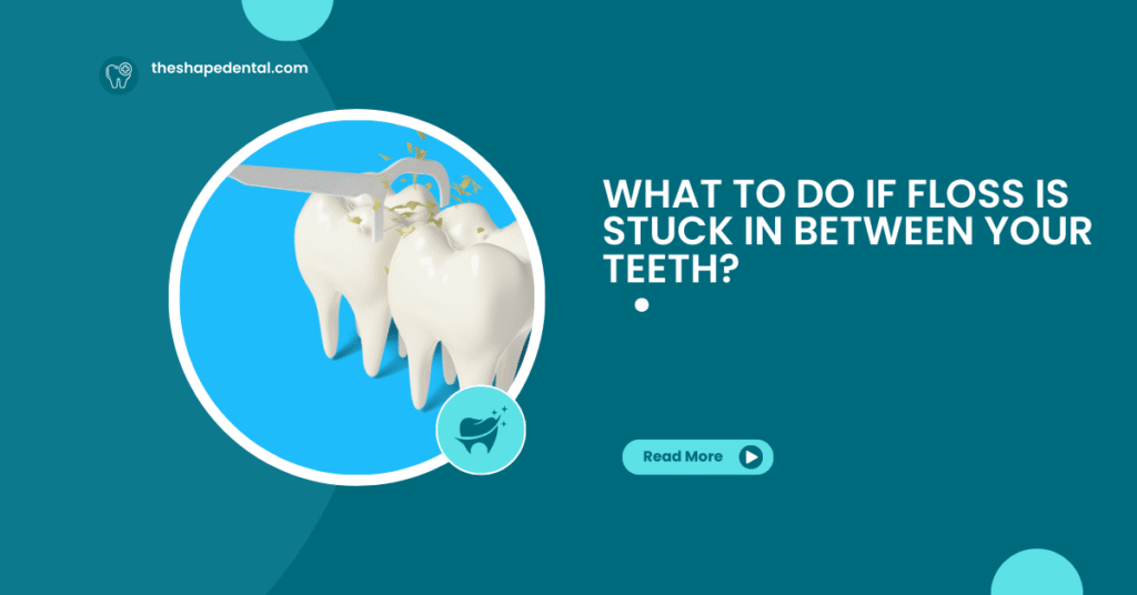 What To Do if Floss Is Stuck in Between Your Teeth