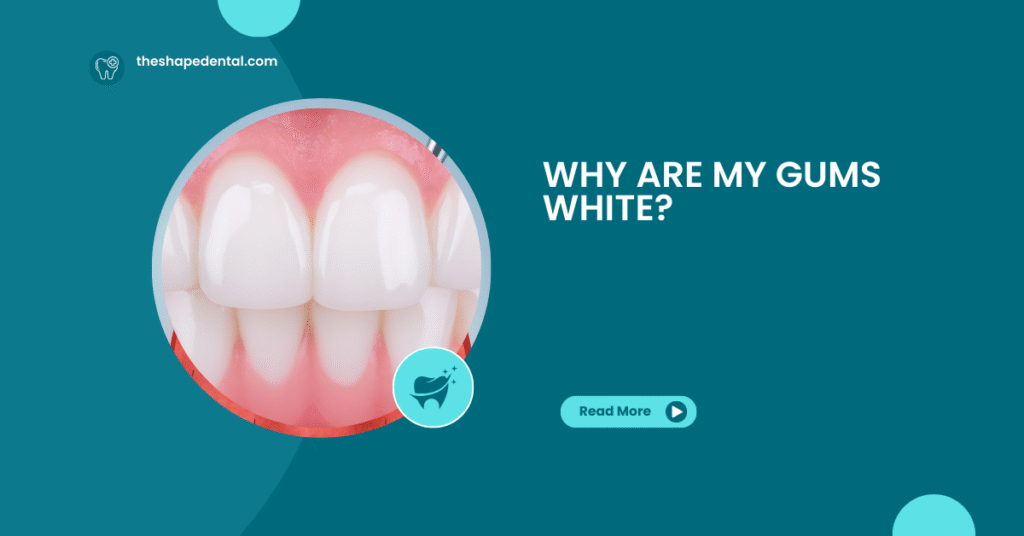 Why Are My Gums White