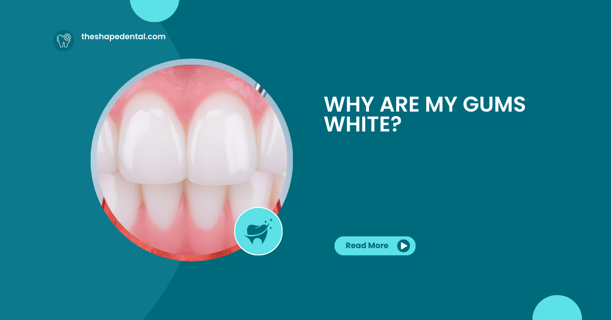 Why Are My Gums White