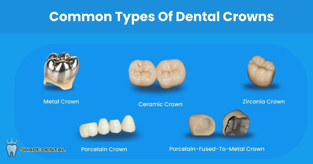 Types of dental crowns including porcelain ceramic and metal crowns